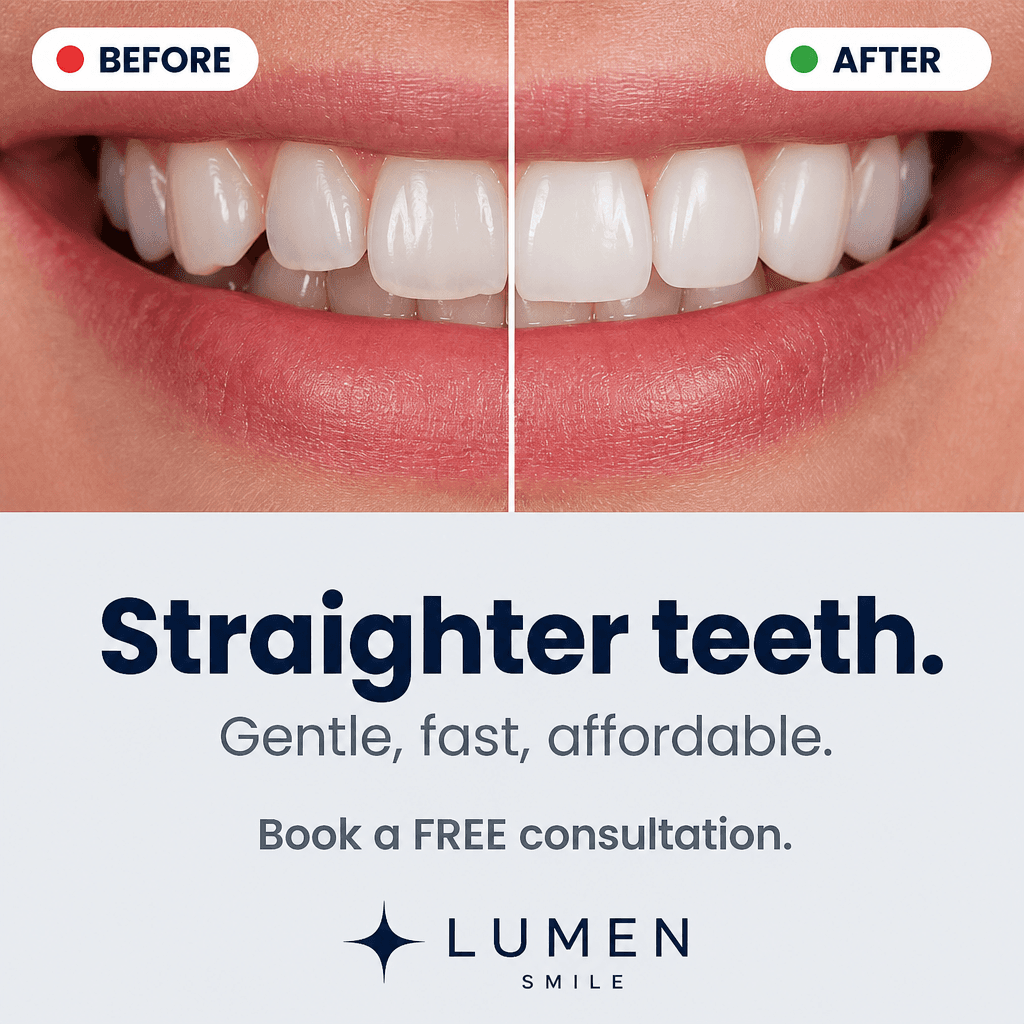 Lumen Smile straighter teeth before after